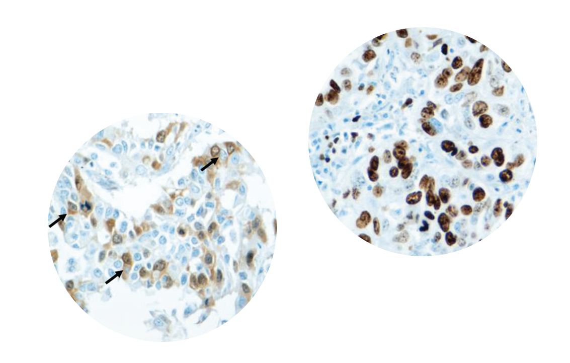 染色切片1